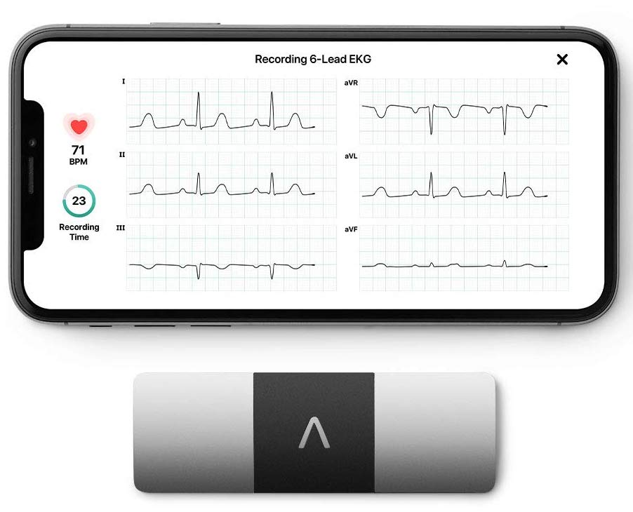 AliveCor KardiaMobile 6L lets you take ECG in just 30 seconds