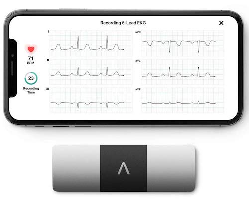 AliveCor KardiaMobile 6L lets you take ECG in just 30 seconds